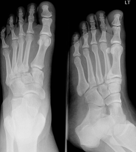 Illustration 1 for Mastering Lower Limb Trauma: AP & Oblique X-ray Diagnosis