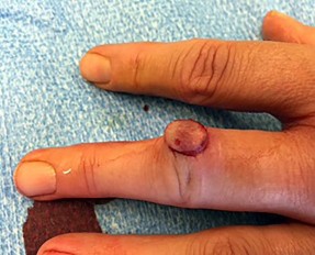 Orthopedic Surgery Mock Exam - Set EE0B0A