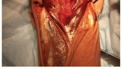 Orthopedic Surgery Board Review MCQs: AAOS Master Bank Part 23