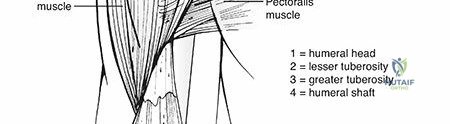 Illustration 3 for Proximal Humerus Fractures: Essential Guide to Anatomy & Recovery