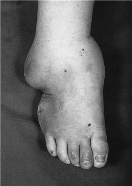 Ace FRCS Orthopaedics: Oxford University Press Adult Pathology Viva