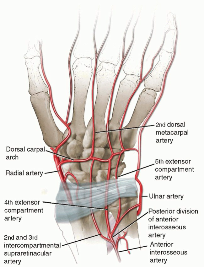 Vascularized Bone Grafting and Capitate Shortening Osteotomy for Treatment of Kienböck Disease