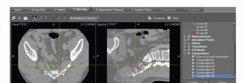 صورة طبية: جراحة أورام العجز: الحفاظ على وظائف الأمعاء والمثانة مع الأستاذ الدكتور محمد هطيف في صنعاء