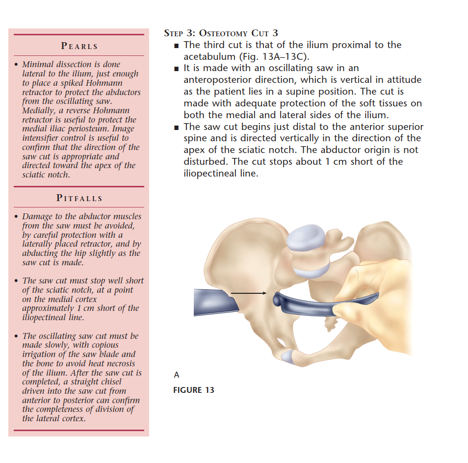 Illustration 28 for Bernese PAO: Unlocking the Procedure with Level V Evidence Insights