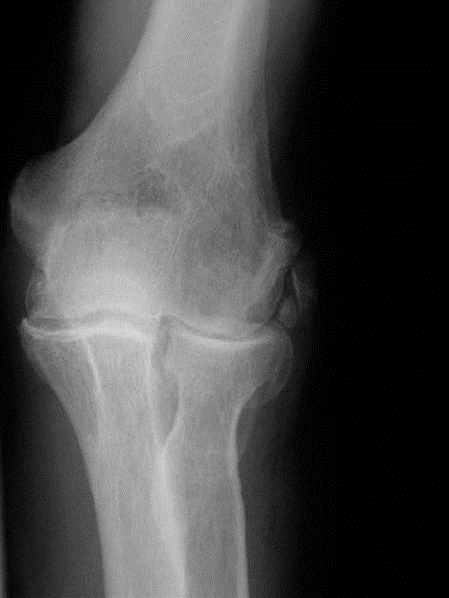 Illustration 2 for Examiner: Good Morning! Ace Your Elbow OA Oral Exam