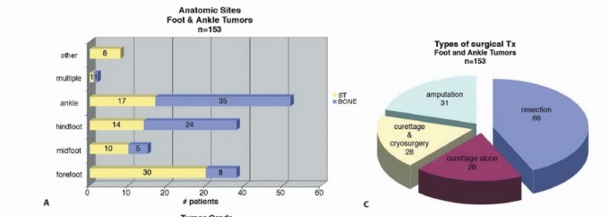 Treating Tumors of the Foot: Optimizing Amputation & Resection