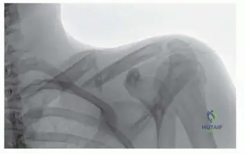 Illustration of david ring md - Dr. Mohammed Hutaif