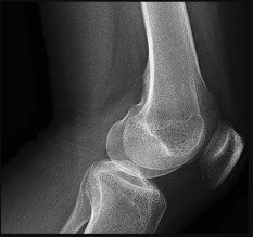 Orthopedic Surgery Mock Exam - Set 407640