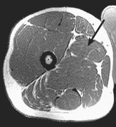 Orthopedic Surgery Mock Exam - Set 6766AD