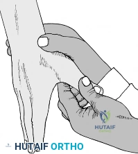 Operative Management of the Thumb: Trapeziometacarpal Synovectomy and Interphalangeal Soft Tissue Reconstruction