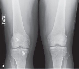 Illustration 9 for Solve Sports Medicine Cases: Uncover Why the Correct Answer Is E