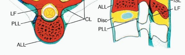 Illustration 2 for Total En Bloc Spondylectomy: Complete Resection for Spinal Tumors