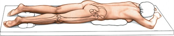 Illustration of medial sural cutaneous - Dr. Mohammed Hutaif