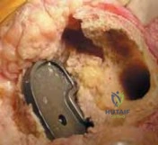 Clinical Image