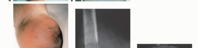 وصف طبي دقيق للمريض