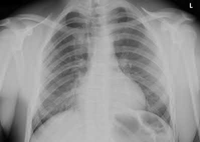 Orthopedic Surgery Mock Exam - Set EFEE5E