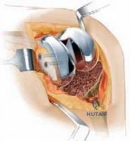 Clinical Image