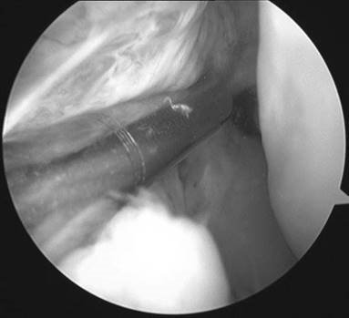 Illustration 10 for Ace FRCS Orthopaedics: Oxford University Press Adult Pathology Viva