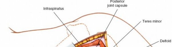 Illustration 173 for Essential Guide: Mastering Every Approach to the Shoulder