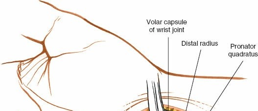 Illustration 72 for Essential Surgical Approaches: Uncover Every Aspect of the Wrist