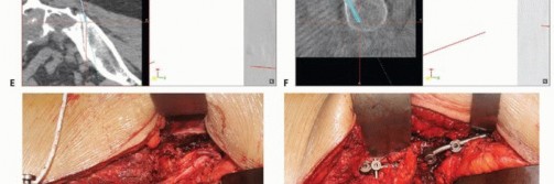 صورة طبية: جراحة أورام العجز: الحفاظ على وظائف الأمعاء والمثانة مع الأستاذ الدكتور محمد هطيف في صنعاء