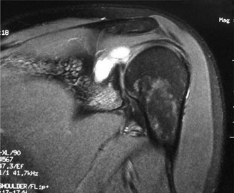 Illustration 13 for Solve Shoulder & Elbow Cases: When a Patient Presents to Clinic