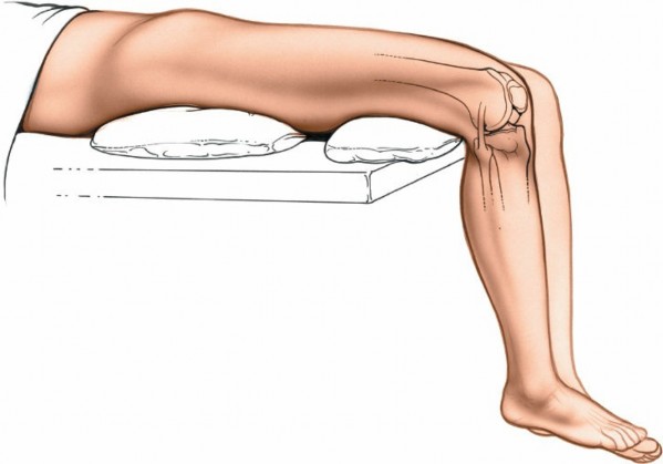 How to Perform an Approach for Lateral Meniscectomy