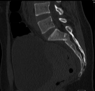 Illustration 9 for Master Orthopedic Spine Cases: Sharpen Your Diagnostic Skills