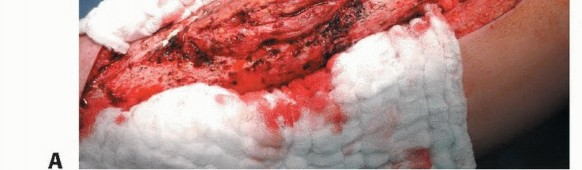 وصف طبي دقيق للمريض