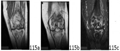 Orthopedic Reconstructi Review | Dr Hutaif Hip & Knee R -...