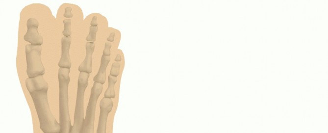 Illustration 29 for Unlock Stability: Medullary Nail Fixation for Tibiotalocalcaneal Arthrodesis