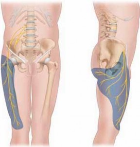 Understanding & Treating Peroneal and Lateral Nerve Injuries