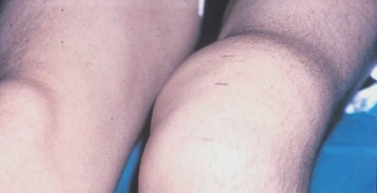 Maximize Strength: Understanding the Science of Type II Fibers