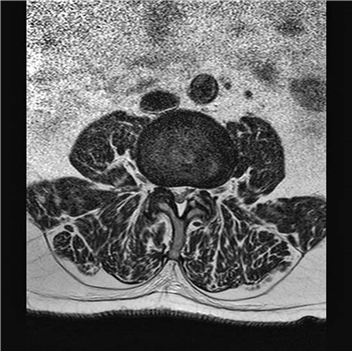 Illustration 21 for Ace FRCS Orthopaedics: Oxford University Press Adult Pathology Viva