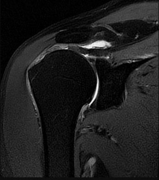 Orthopedic Shoulder And Review | Dr Hutaif Shoulder & E -...