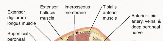 Chronic Exertional Compartment Syndrome: Causes, Symptoms & Relief