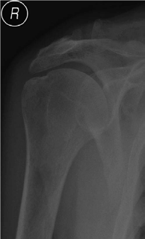 Illustration 2 for Elbow Structured Oral: Master This Orthopedic Exam Question 3