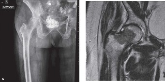 Illustration of management of difficult - Dr. Mohammed Hutaif