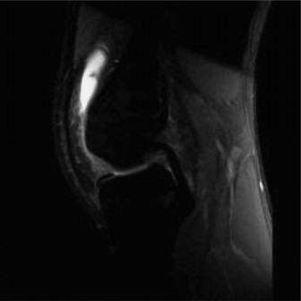 Illustration 2 for Pediatric Pain & Swelling: 16 Cases Solved & Diagnoses Revealed