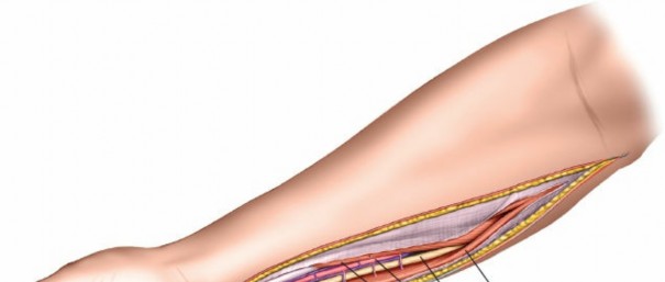 Illustration 96 for Mastering Approaches to the Upper Third of the Radius