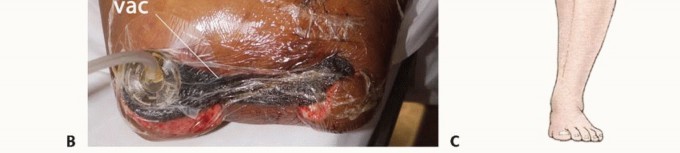 وصف طبي دقيق للمريض