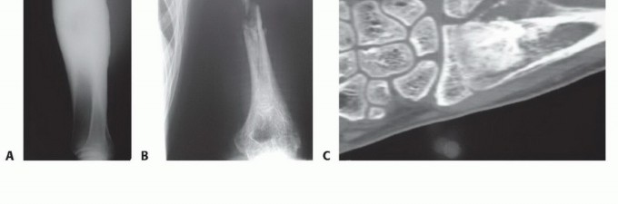 وصف طبي دقيق للمريض