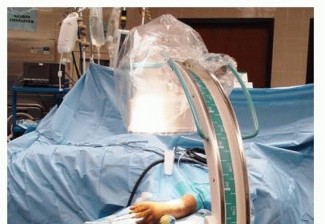 Bridge Plating of Distal Radius Fractures