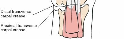 Illustration 142 for Essential Surgical Approaches: Uncover Every Aspect of the Wrist