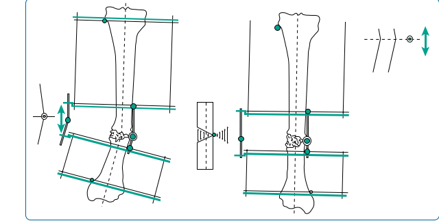 Illustration 21 for Limb Reconstruction: Restoring Function for Challenges Near and Far