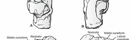 Illustration 2 for Mastering First MTP Joint & Forefoot Fractures: A Comprehensive Guide