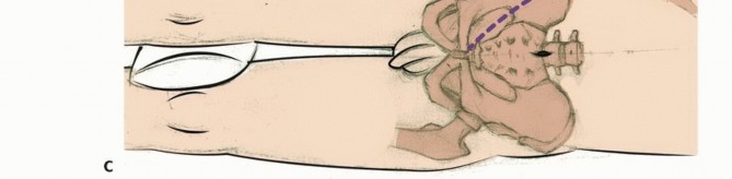 وصف طبي دقيق للمريض