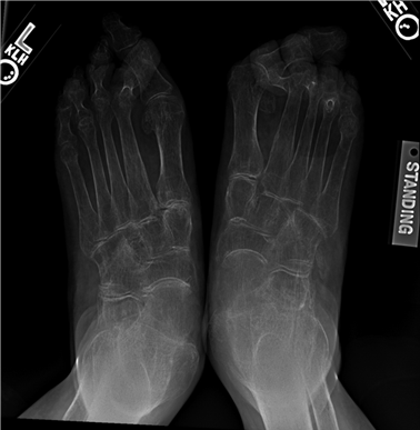 Illustration 97 for First Metatarsal Surgery: Expert Solutions for Foot & Ankle Pain