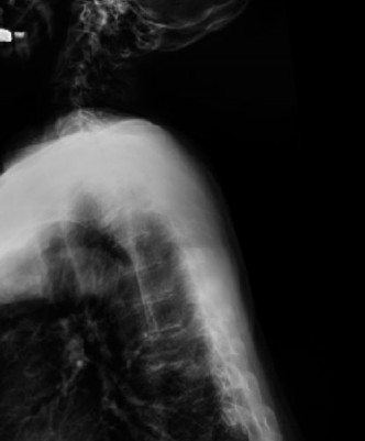 Illustration 15 for Master Orthopedic Spine Cases: Sharpen Your Diagnostic Skills