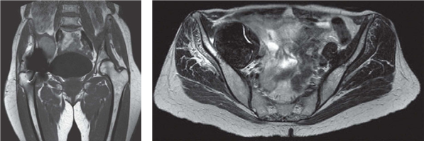 Illustration 2 for Structured Hip Oral Examination: Master This Complex Case